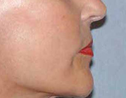 Anti Aging