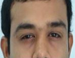 Botox Treatment