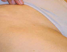 Pain-Free Hair Removal