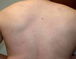 Pain-Free Hair Removal
