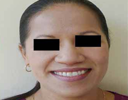 Pigmentation