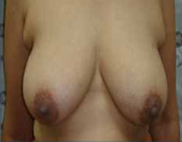 1b