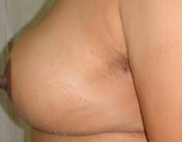 3a