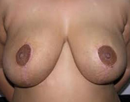 3a