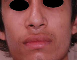3a