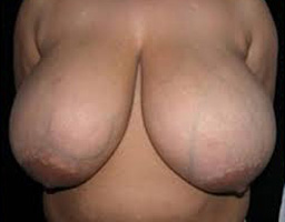 3b