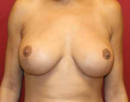 5a